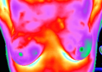 TH3