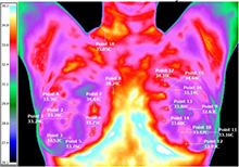 Breast Exam Result
